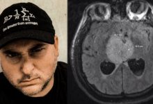 Photo of Obywatel D.C. ma złośliwego guza mózgu: “Generalnie RIP”